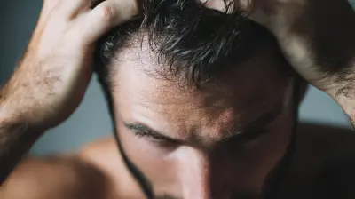 Strategies to Prevent Hair Loss in Men: A Comprehensive Guide
