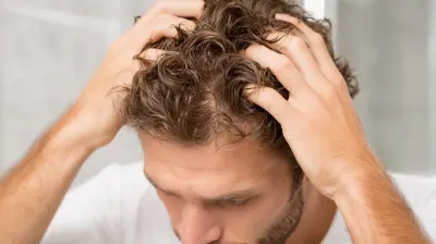 Strategies to Prevent Hair Loss in Men: A Comprehensive Guide