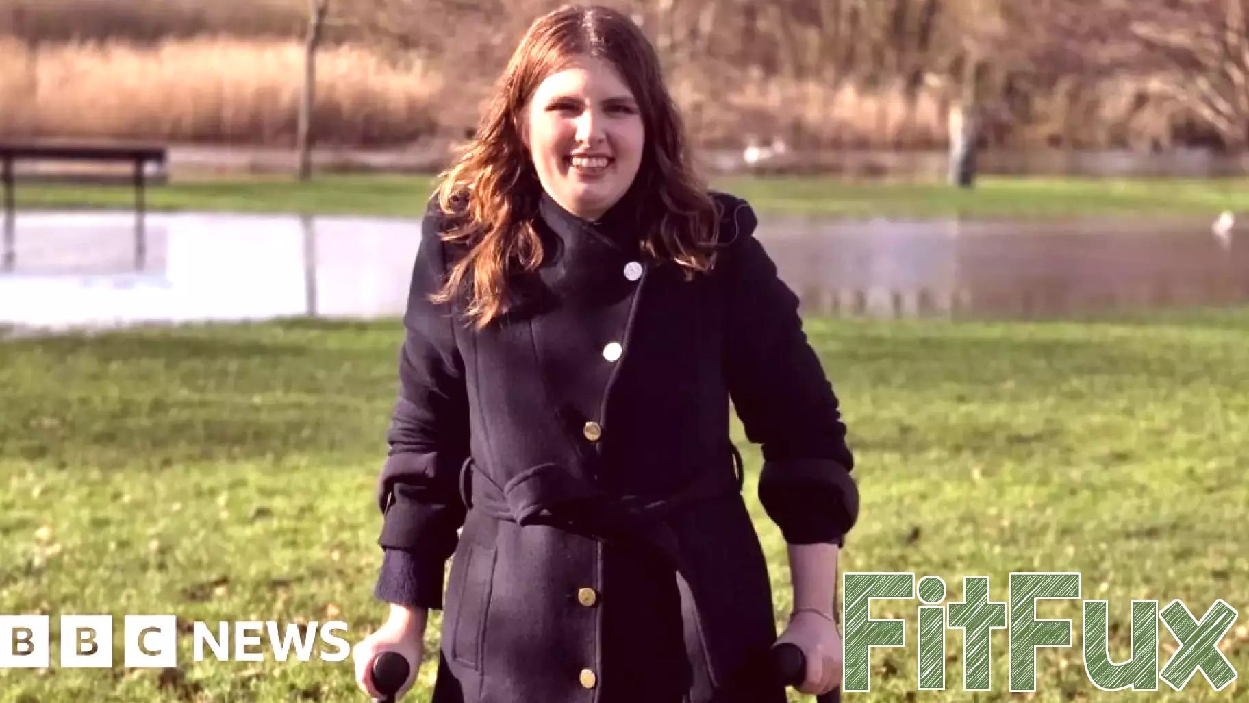 Annual health checks could end 'fragmented' cerebral palsy care