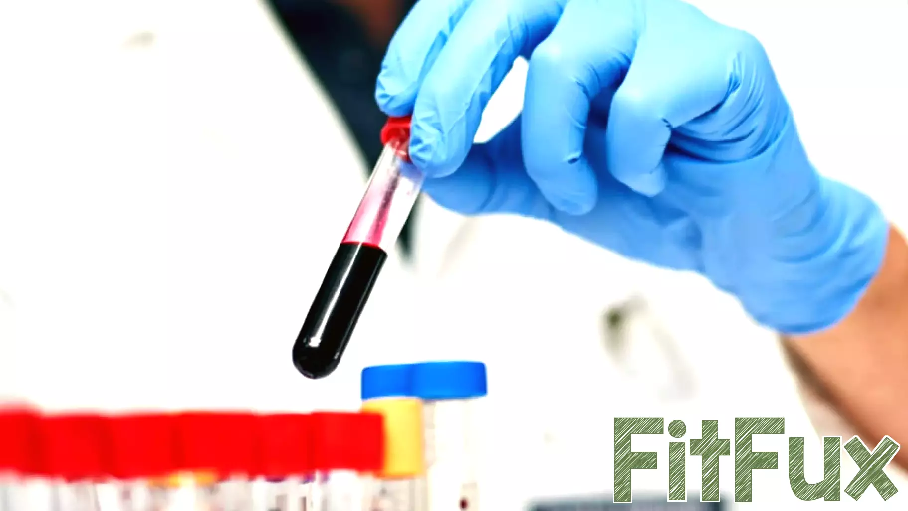Breakthrough in Cholesterol Treatment Offers Hope for Millions