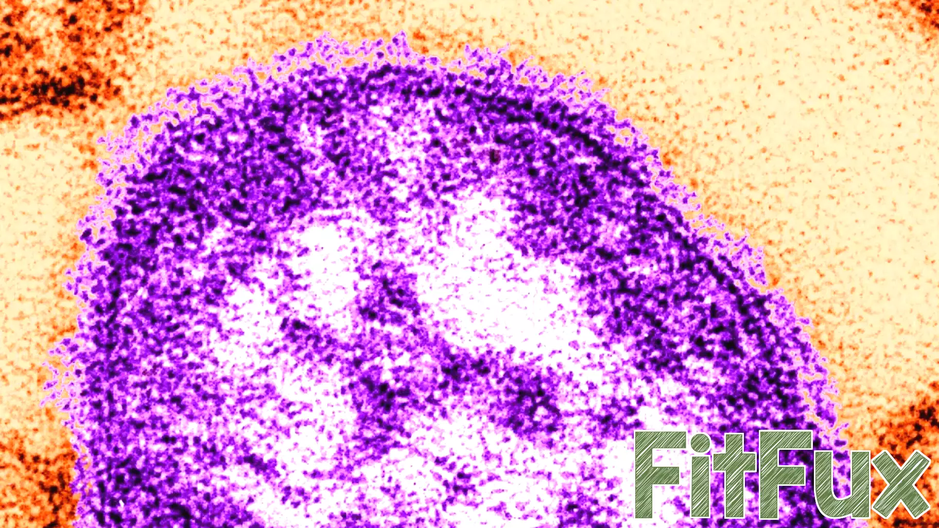 Chautauqua, Niagara counties motoring Erie County measles case