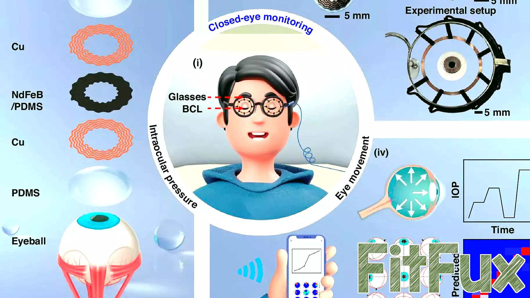 Innovative Smart Contact Lens Monitors Eye Health Around the Clock