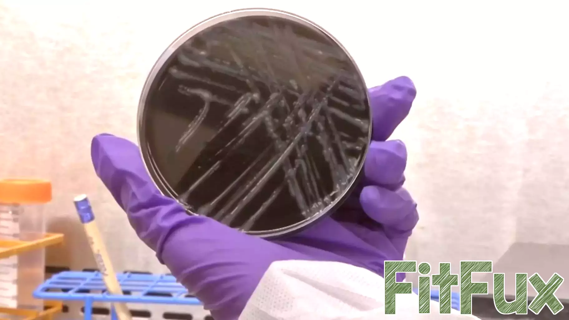 Second person dies in Upper East Side Legionnaires' disease outbreak