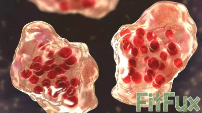 2 measles exposure sites identified at Salem health centers, Oregon officials say