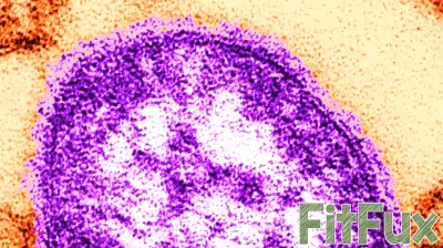 Chautauqua, Niagara counties motoring Erie County measles case