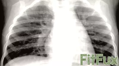 Understanding HMPV: The Virus Currently Spreading in China